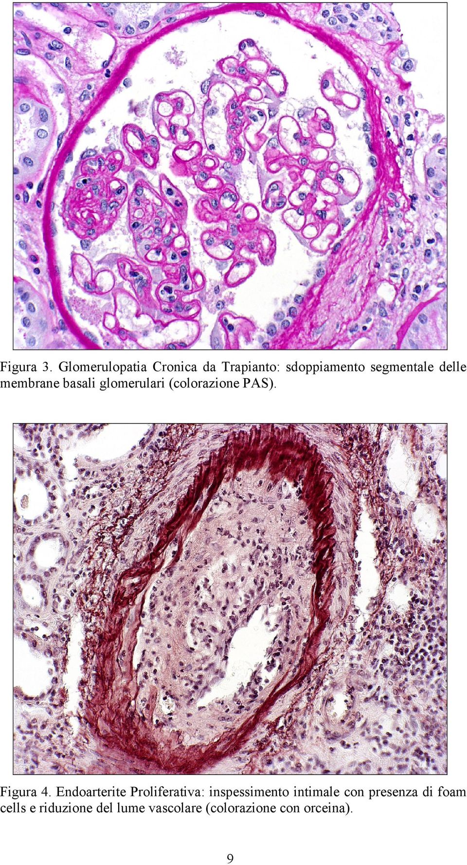 membrane basali glomerulari (colorazione PAS). Figura 4.