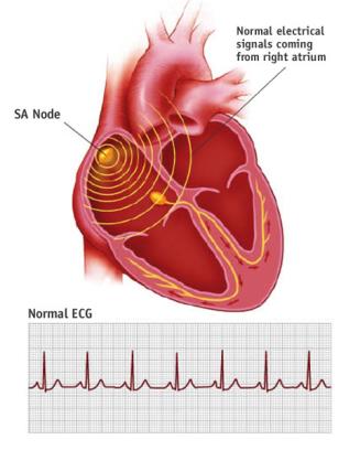 3 L elettrocardiogramma L'elettrocardiogramma (ECG) è la riproduzione grafica dell'attività elettrica durante il suo funzionamento, registrata dalla superficie del corpo (fig 24).