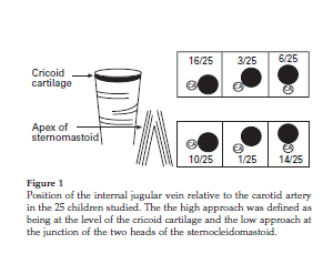 RAPPORTI ANATOMICI Position of the internal jugular vein in children. A study of the anatomy using ultrasonography. Mallinson C. Paediatr Anaesth.