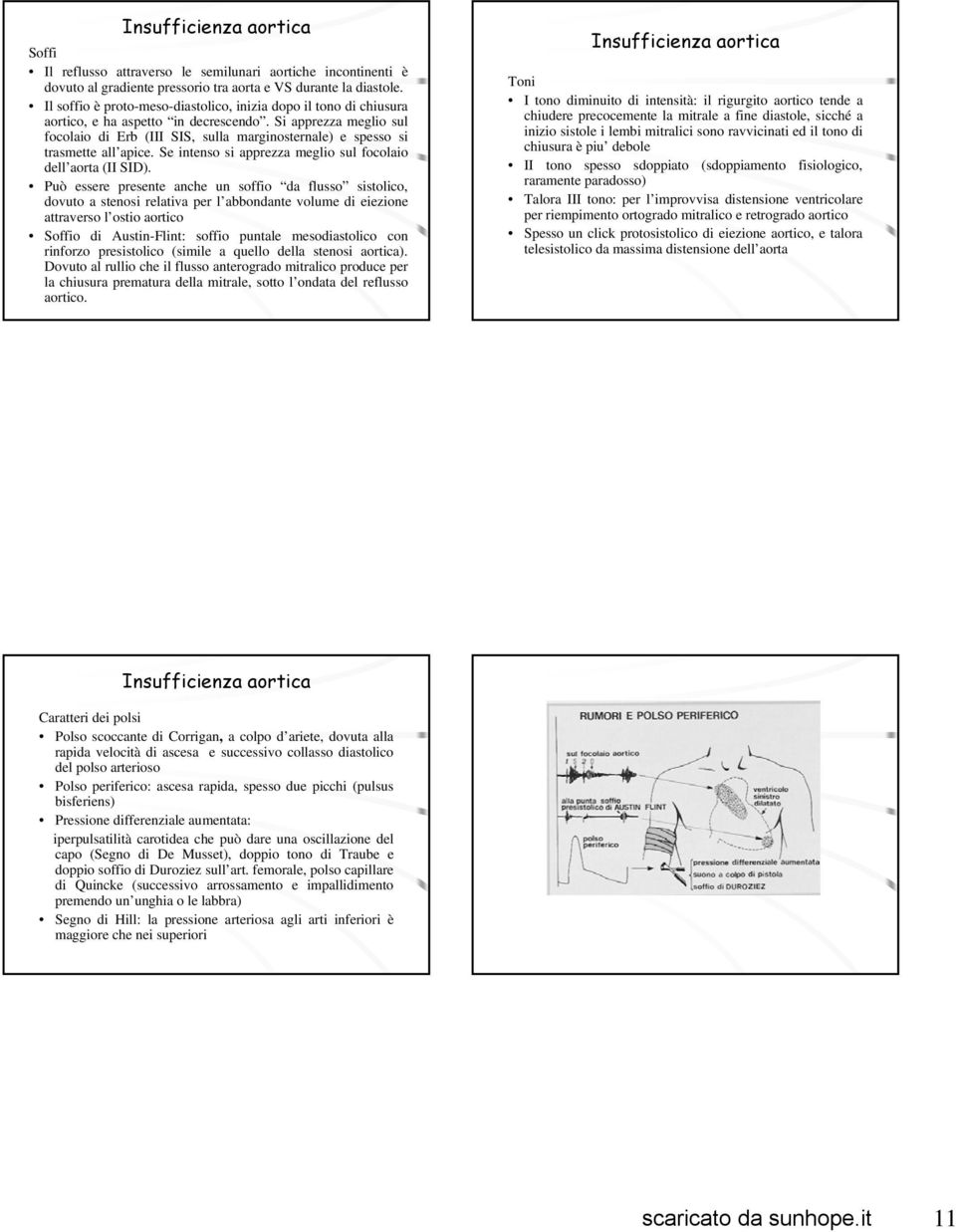 Si apprezza meglio sul focolaio di Erb (III SIS, sulla marginosternale) e spesso si trasmette all apice. Se intenso si apprezza meglio sul focolaio dell aorta (II SID).