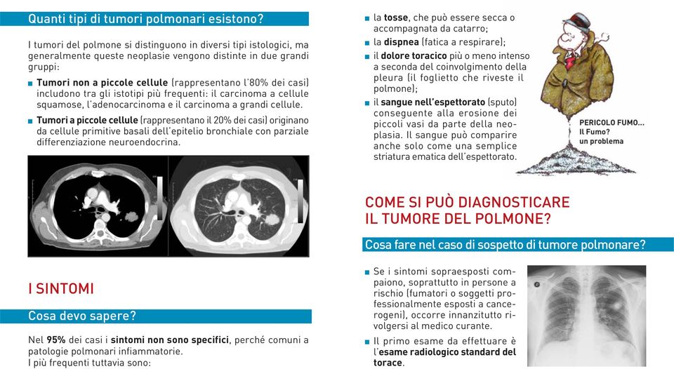 includono tra gli istotipi più frequenti: il carcinoma a cellule squamose, l adenocarcinoma e il carcinoma a grandi cellule.