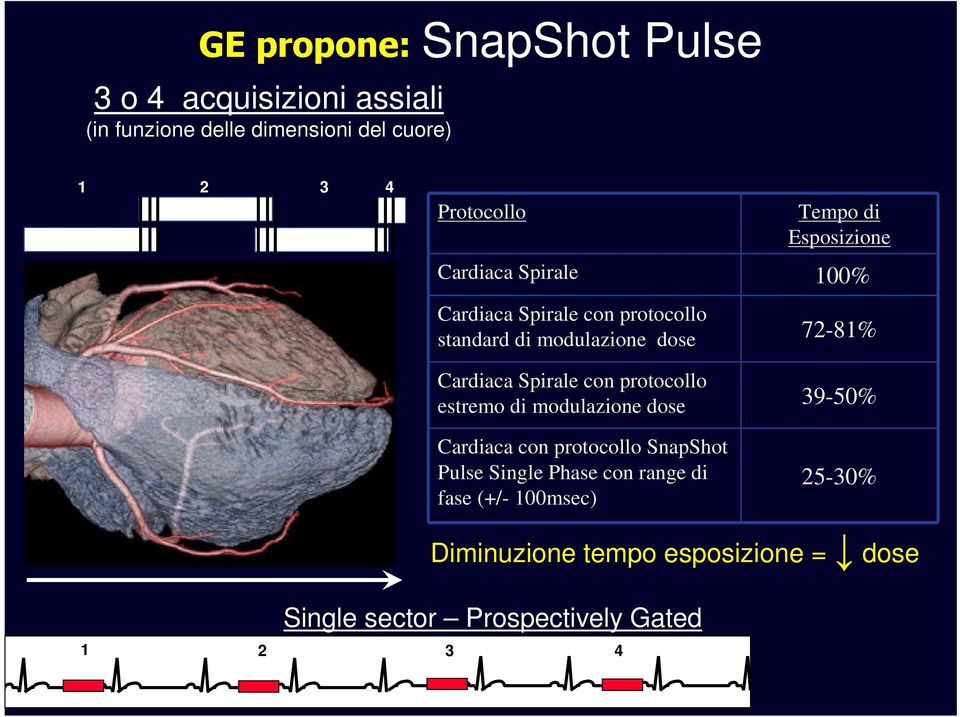 Cardiaca Spirale con protocollo estremo di modulazione dose 39-50% Cardiaca con protocollo SnapShot Pulse Single