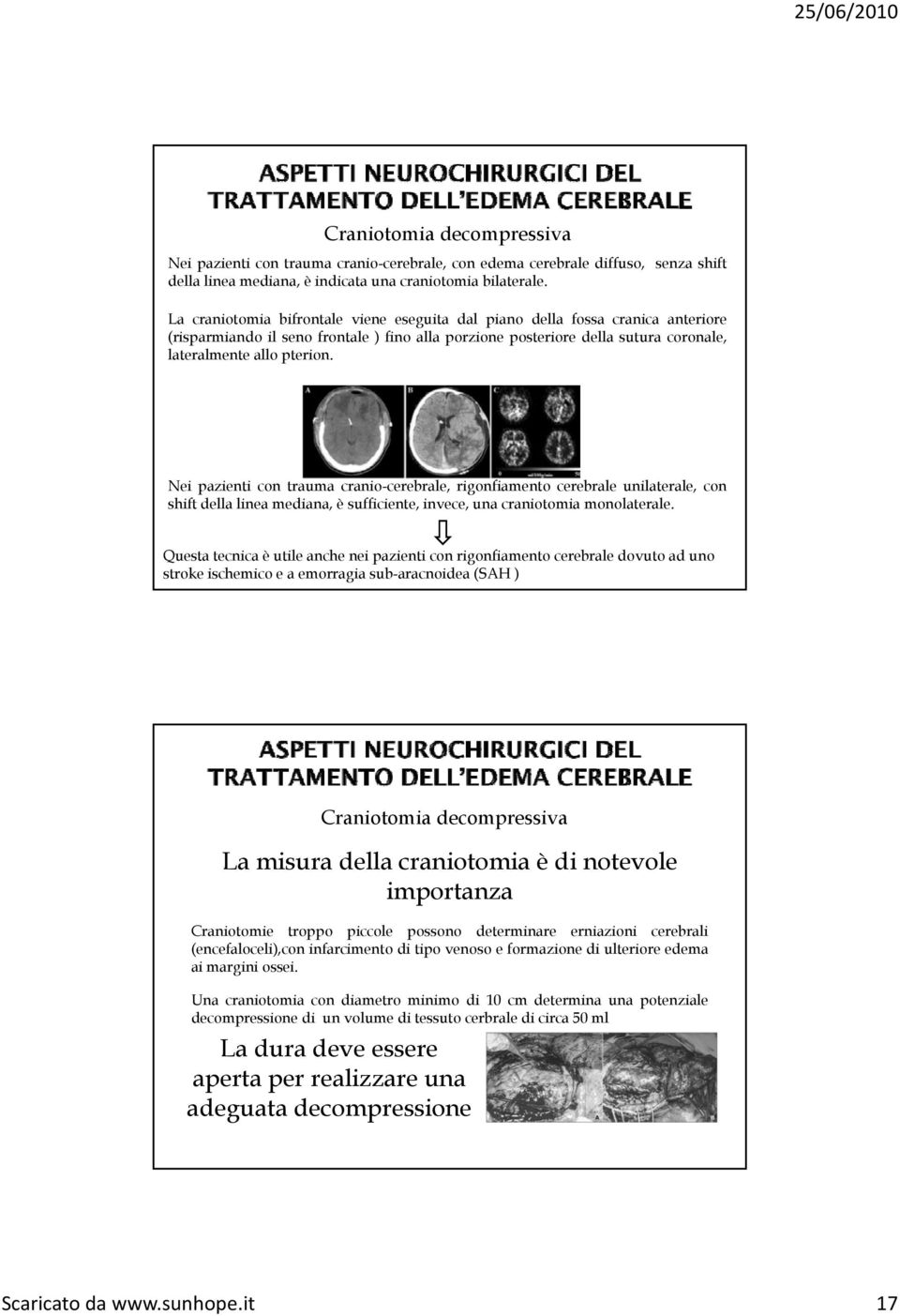 Nei pazienti con trauma cranio-cerebrale, rigonfiamento cerebrale unilaterale, con shift della linea mediana, è sufficiente, invece, una craniotomia monolaterale.