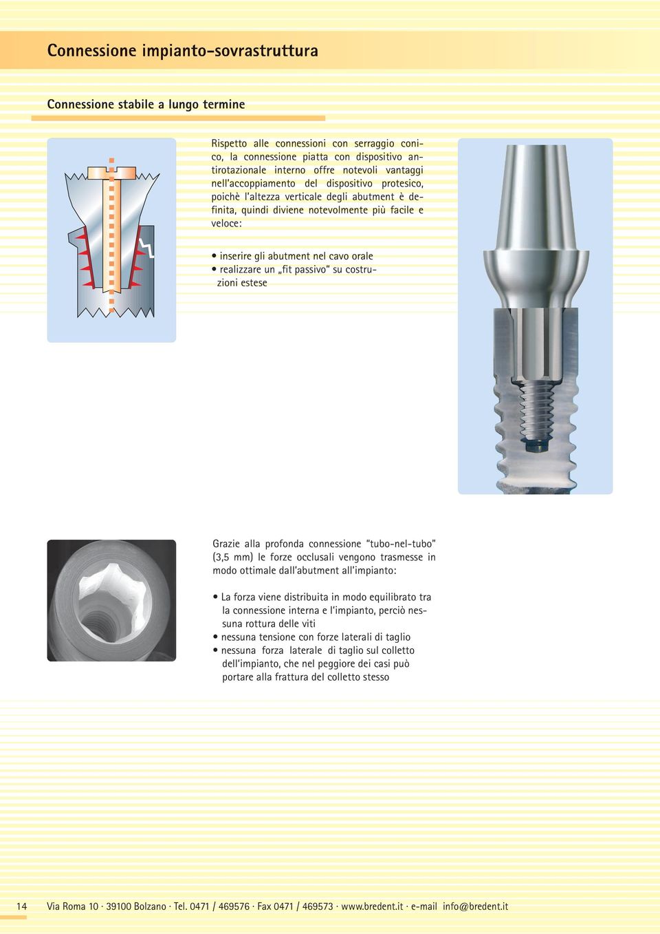 realizzare un fit passivo su costru- zioni estese Grazie alla profonda connessione tubo-nel-tubo (3,5 mm) le forze occlusali vengono trasmesse in modo ottimale dall abutment all impianto: La forza