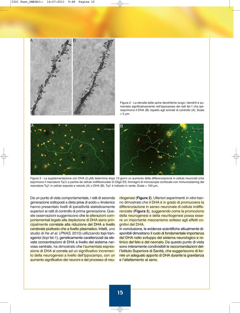Figura 3 - La supplementazione con DHA (5 µm) determina dopo 13 giorni un aumento della differenziazione in cellule neuronali (che esprimono il marcatore Tuj1) a partire da cellule indifferenziate