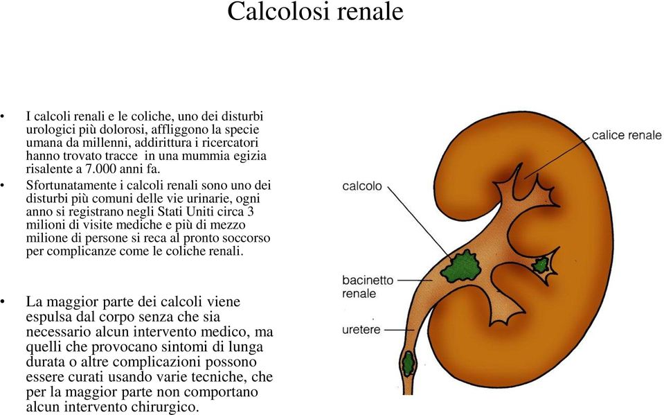 Sfortunatamente i calcoli renali sono uno dei disturbi più comuni delle vie urinarie, ogni anno si registrano negli Stati Uniti circa 3 milioni di visite mediche e più di mezzo milione di