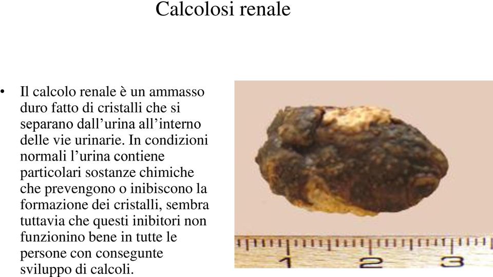 In condizioni normali l urina contiene particolari sostanze chimiche che prevengono o