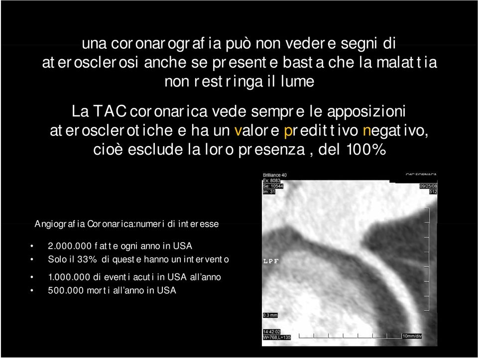 esclude la loro presenza, del 100% Angiografia Coronarica:numeri di interesse 2.000.