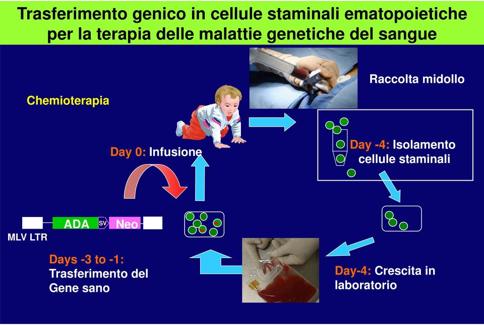 0: Infusione Day -4: Isolamento cellule staminali MLV LTR ADA SV Neo