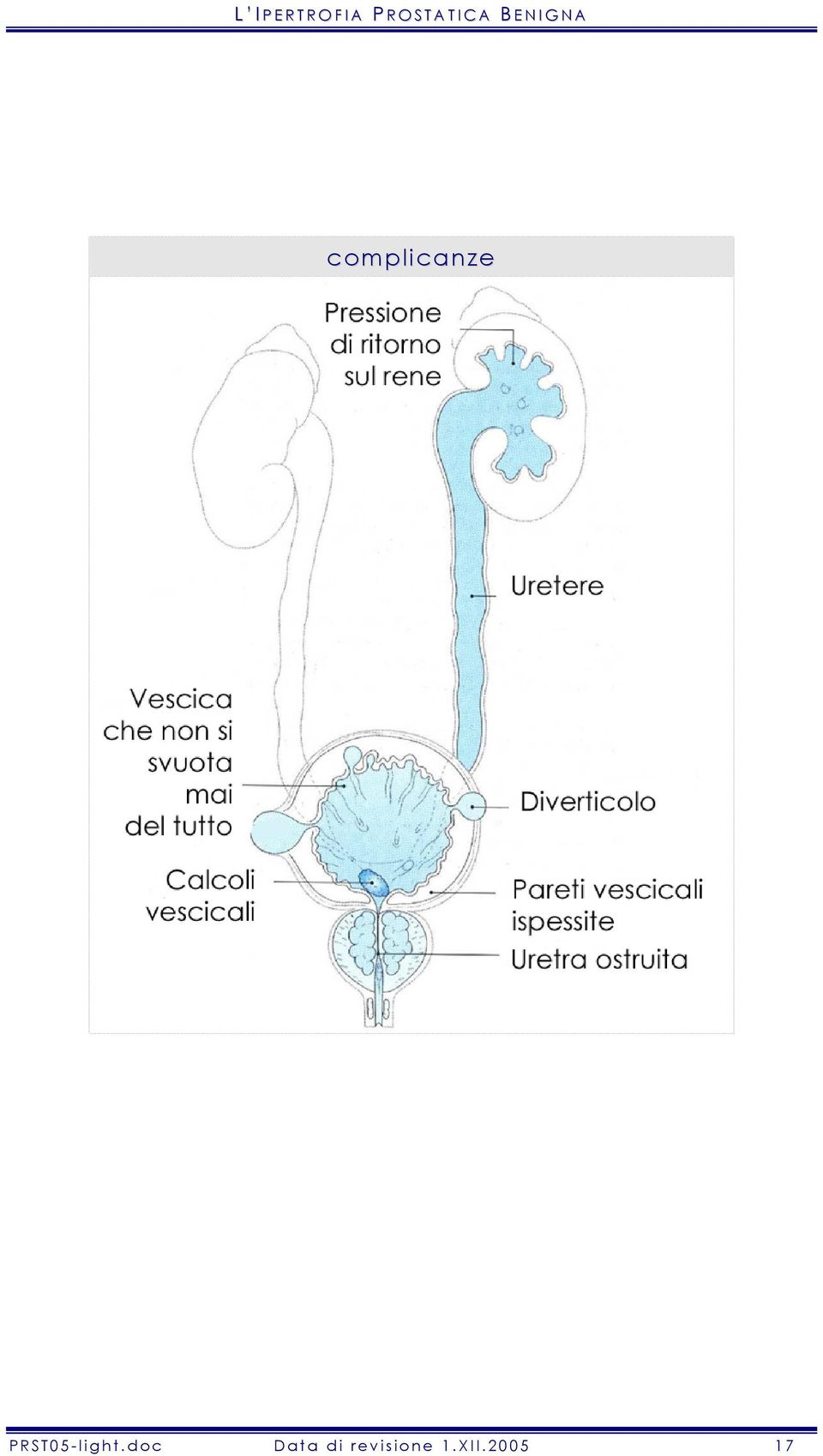 complicanze PRST05-light.