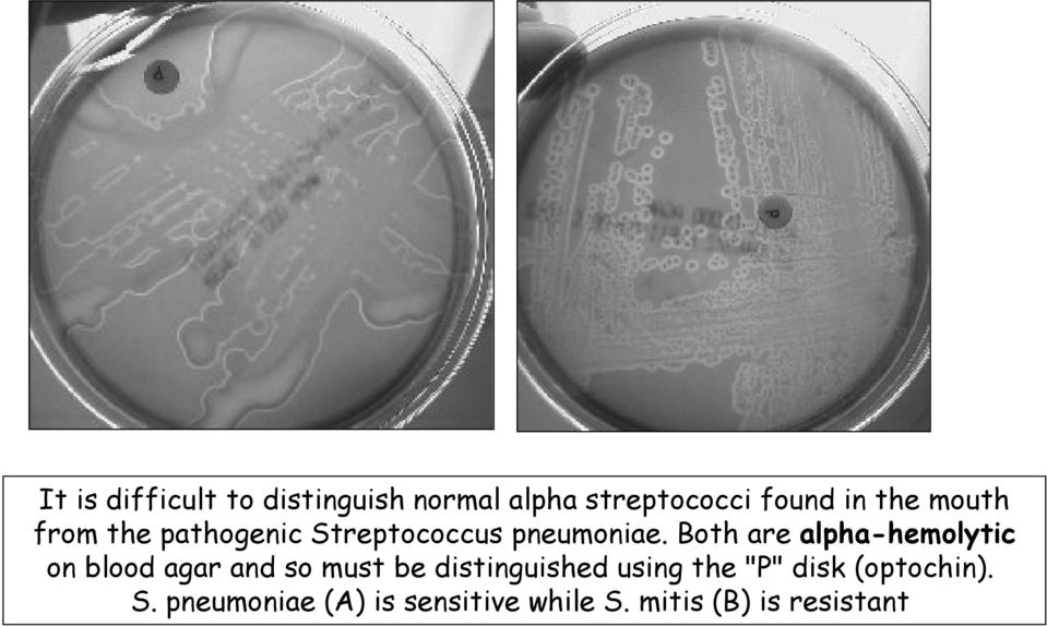 Both are alpha-hemolytic on blood agar and so must be distinguished