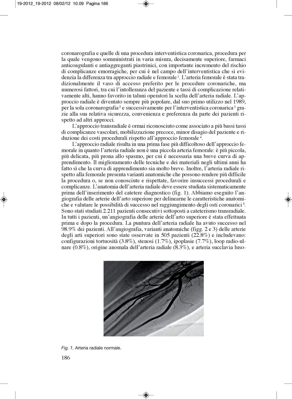 antiaggreganti piastrinici, con importante incremento del rischio di complicanze emorragiche, per cui è nel campo dell interventistica che si evidenzia la differenza tra approccio radiale e femorale