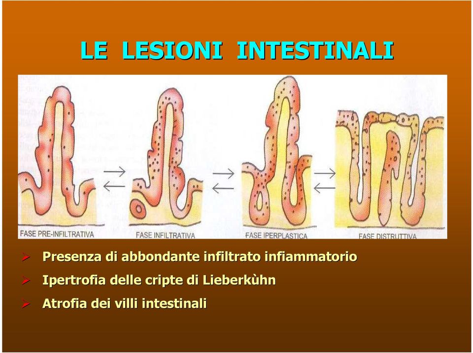 infiammatorio Ipertrofia delle