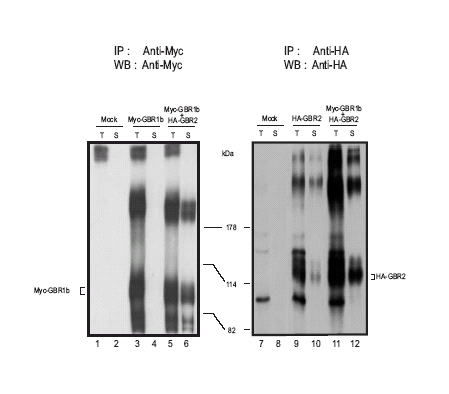 Immunoprecipitazione su estratti totali e membrane di cellule trasfettate rispettivamente con : Myc GBR1b e HA GBR2 o cotrasfettate Myc GBR1b e HA GBR2 GBR1b è espresso solo nella frazione