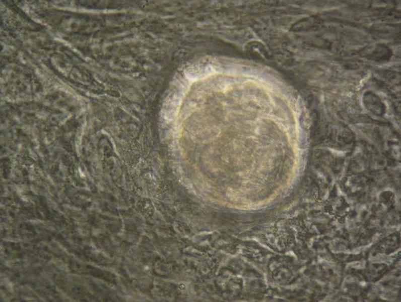Fig. 8 Fotografia 20x di co-coltura fibroblasti-cheratinociti