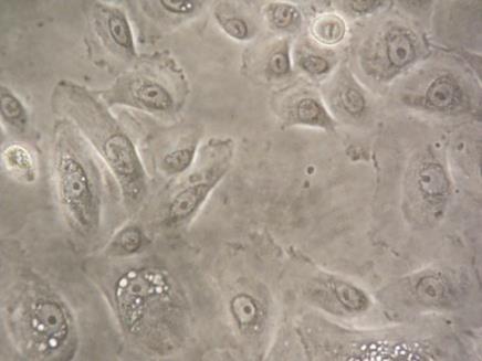 Fig.12,13,14 Fotografie 10-20-40x dei campioni cheratinociti