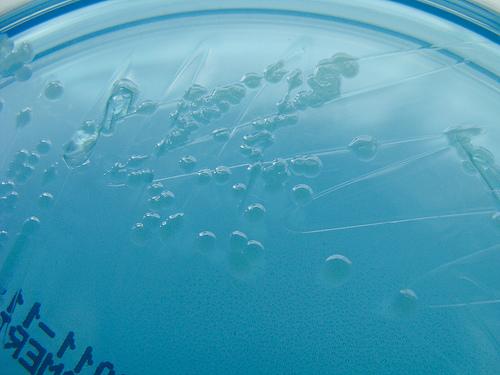 6 a prova URINOCOLTURA Esame microscopico Bacilli Gram negativi Test supplementari Risultato Ossidasi Test