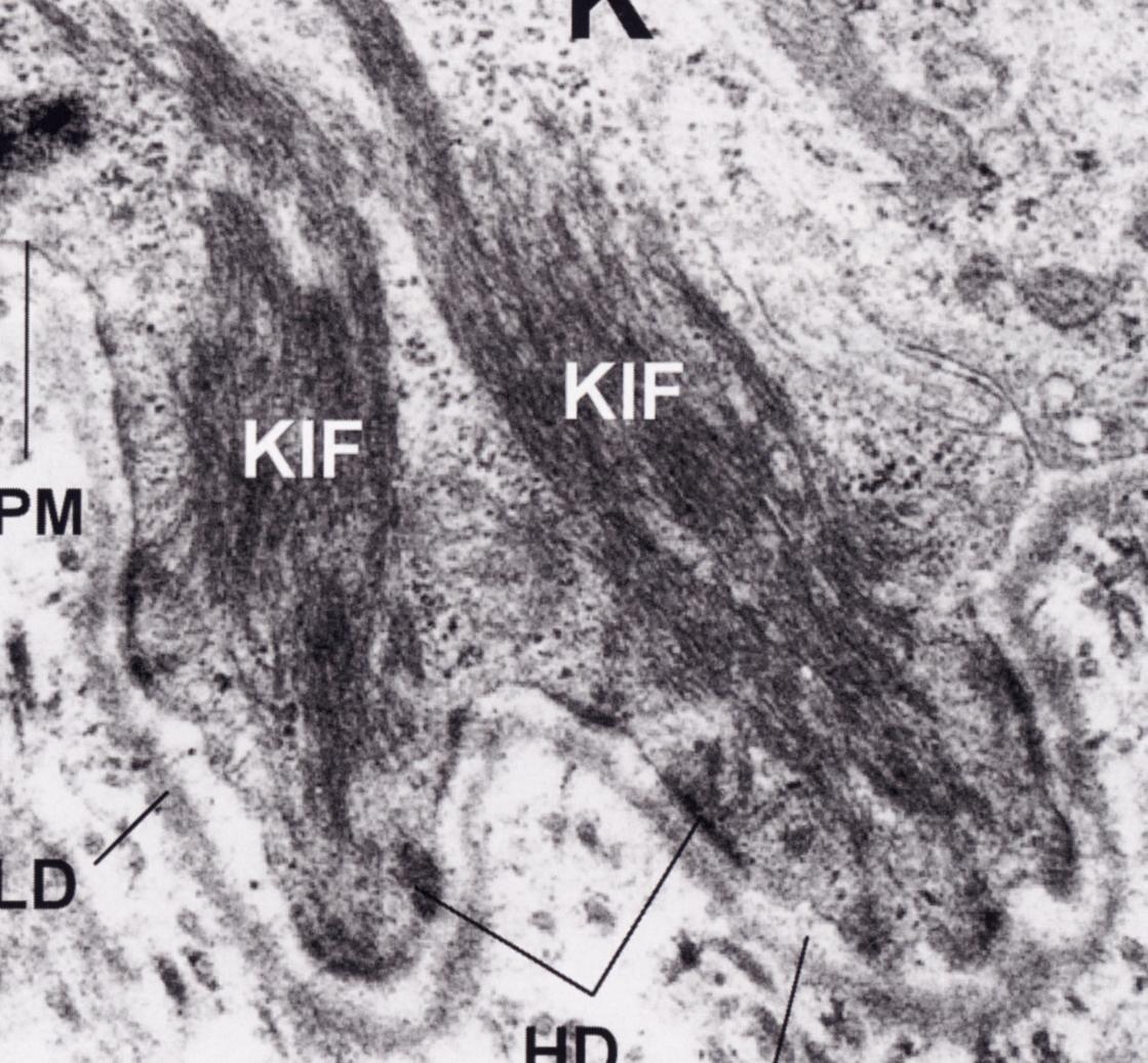 Gli altri dispositivi di giunzione nei quali quali i filamenti intermedi si inseriscono sono gli emidesmosomi, che ancorano i cheratinociti basali alla matrice extracellulare sottostante.