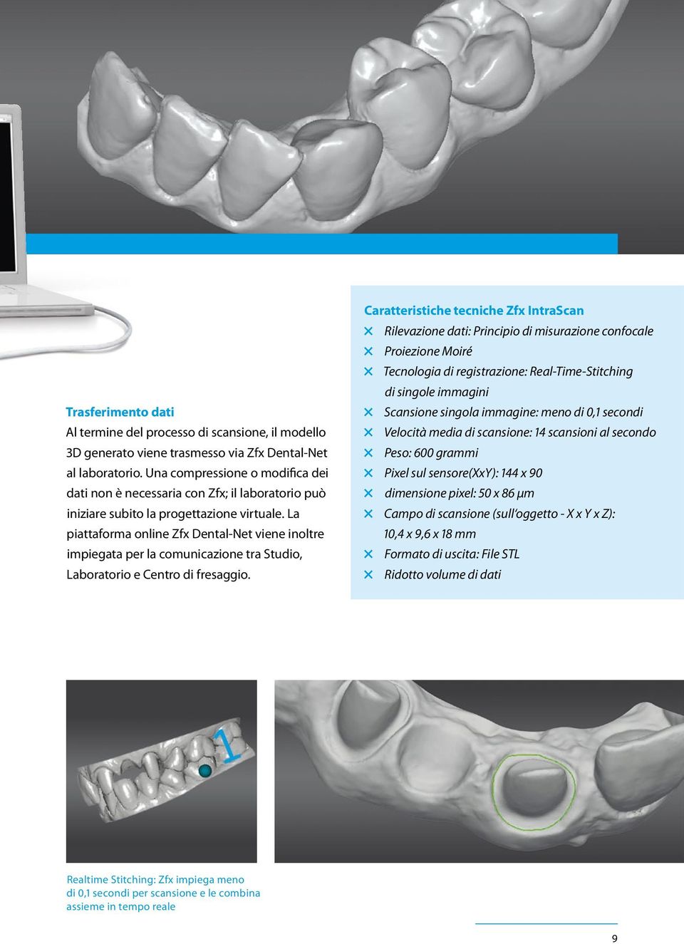 La piattaforma online Zfx Dental-Net viene inoltre impiegata per la comunicazione tra Studio, Laboratorio e Centro di fresaggio.