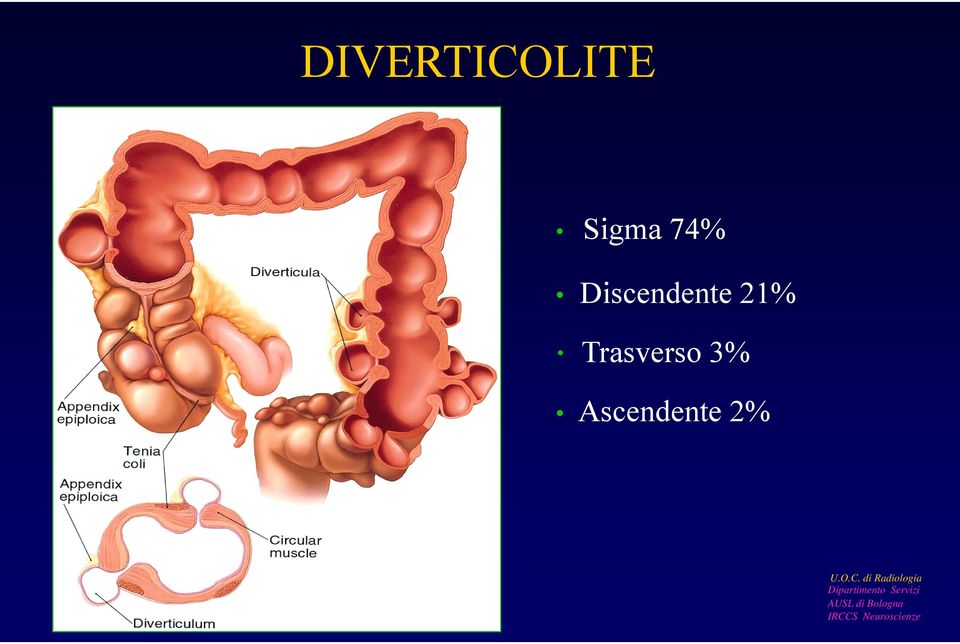 Discendente 21%