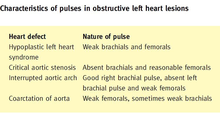 Cuore sinistro ipoplasico Stenosi aortica critica Interruzione dell arco aortico