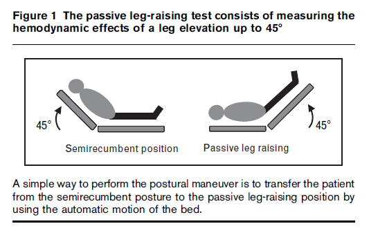 PASSIVE