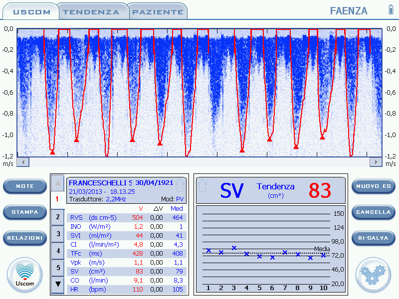 SOTTO DOPAMINA 6 γ/kg/min PA 108/44, SBLOCCO DIURESI SVI 44 ml/m2 e CI