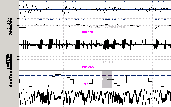 il giorno successivo quadro clinico invariato ma ulteriore peggioramento delle