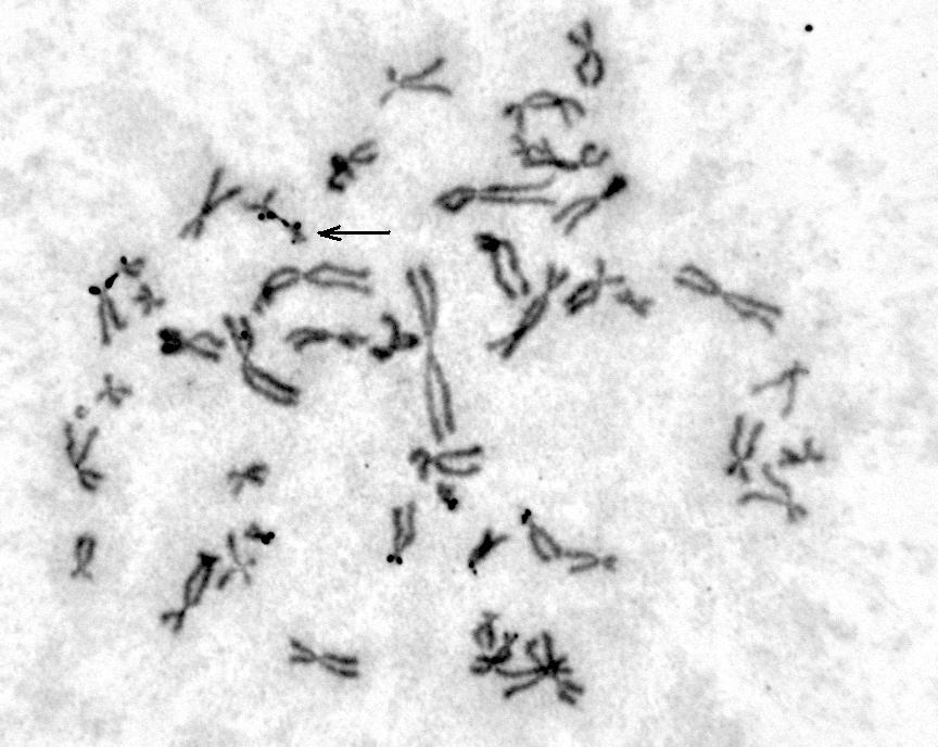 Fig. 3 - FISH con sonda LSI per la regione