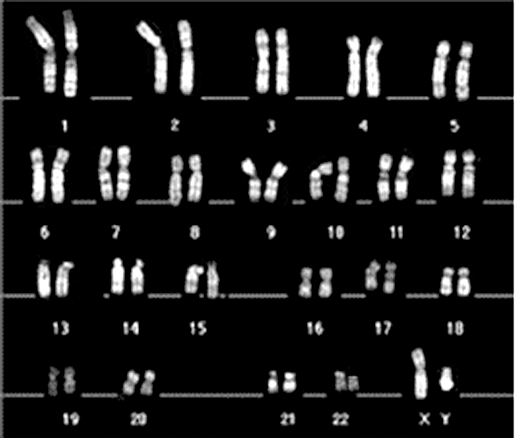 Cariotipi umani a confronto 1-3 gruppo A 4-5 gruppo B X-6-12 gruppo C 13-15 gruppo D 16-18 gruppo E 19-20 gruppo F