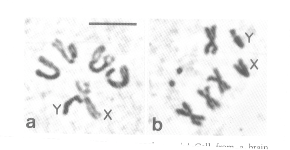 Un caso particolare di cromosomi Senza colchicina Con