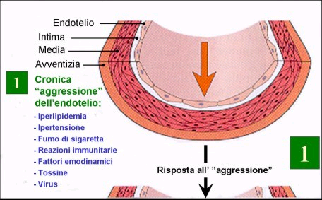 Alterazioni