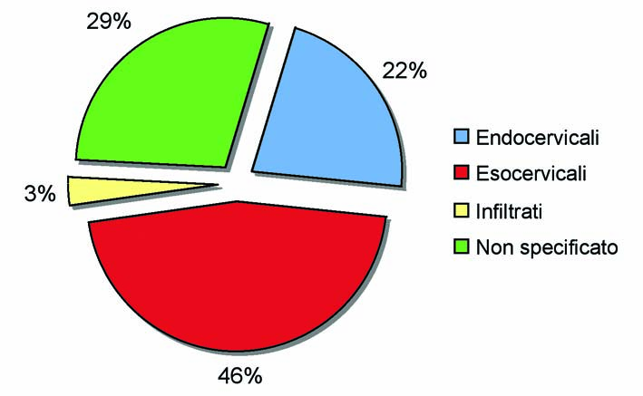 RELAZIONE SULLO STATO DI SALUTE DELLA POPOLAZIONE PUGLIESE I tumori esocervicali (46%) costituiscono la maggior parte dei tipi istologici (Grafico 6.6.2)