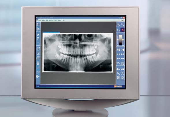 ORTHOPHOS XG 5 la qualità dell immagine resa facile. nitido preciso La base per immagini nitide. La radiografia panoramica è un procedimento a strati.