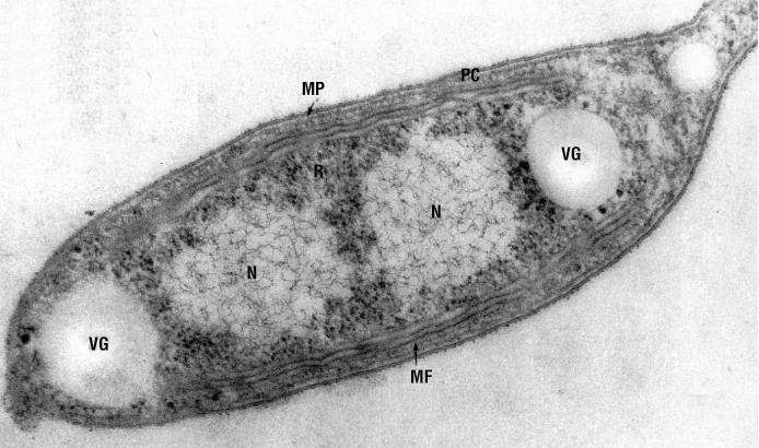 Morfologia di un batterio fotosintetico visibile al TEM MP: membrana plasmatica PC:
