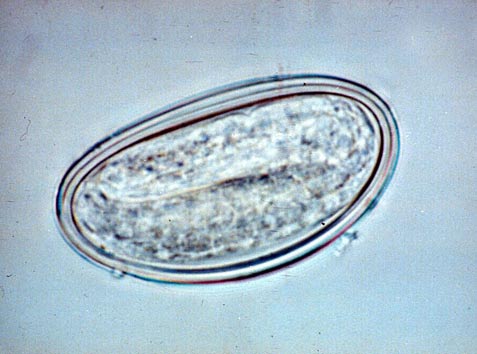 Figura ni22 Enterobius vermicularis: Ciclo di vita. Gli Ossiuri adulti vivono nel colon dell uomo.