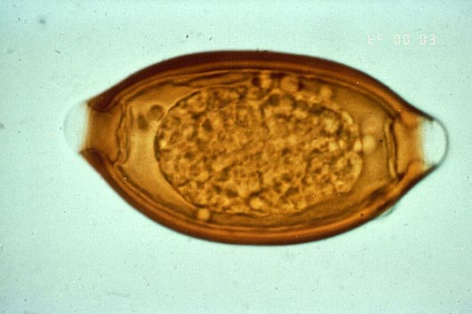 Figura ni1. Trichuris: Ciclo di vita. I vermi adulti (lunghi circa 4 cm) vivono nel cieco e nel colon ascendente. Le femmine nel cieco depongono tra le 3.000 e le 10.000 uova al giorno.