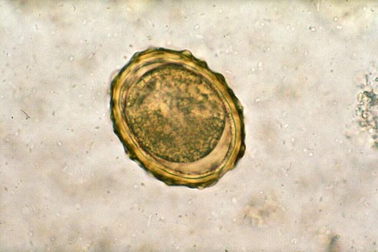 Figura ni6 Ascaris lumbricoides: Ciclo di vita. I vermi adulti vivono nel lume dell intestino tenue (A). Una singola femmina può produrre fino a circa 250.