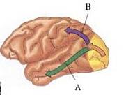 DSA (lettura)- possibili deficit neurocognitivicognitivi Sistema magnocellulare (A): deficit dei meccanismi sensoriali non linguistici che alterano i processi di base di elaborazione visiva e uditiva