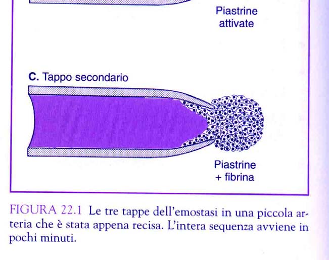 Al danno vascolare segue: VASOCOSTRIZIONE: dovuta a un meccanismo neurogeno riflesso e alla secrezione di fattori locali vasocostrittori (endotelina).