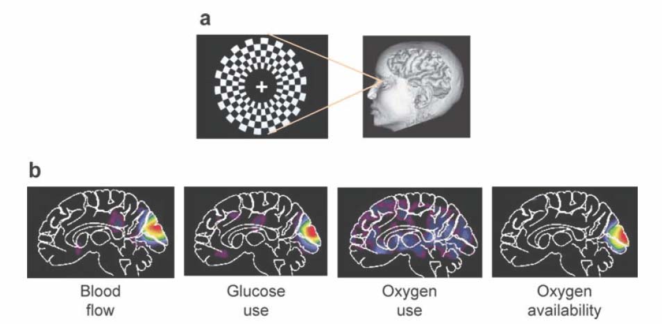 Esplorazione funzionale in vivo dei correlati neurometabolici