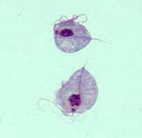 Trichomonas vaginalis: microscopia ottica Trofozoiti di T.