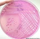 ESEMPIO DI TERRENO SELETTIVO E DIFFERENZIALE Lattosio fermentante Agar Mac