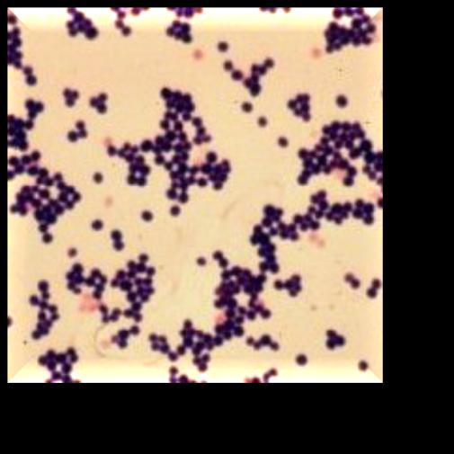 Cocchi Gram positivi: Streptococcus pneumoniae Test della sensibilità all optochina AgarSangue (5% sangue di