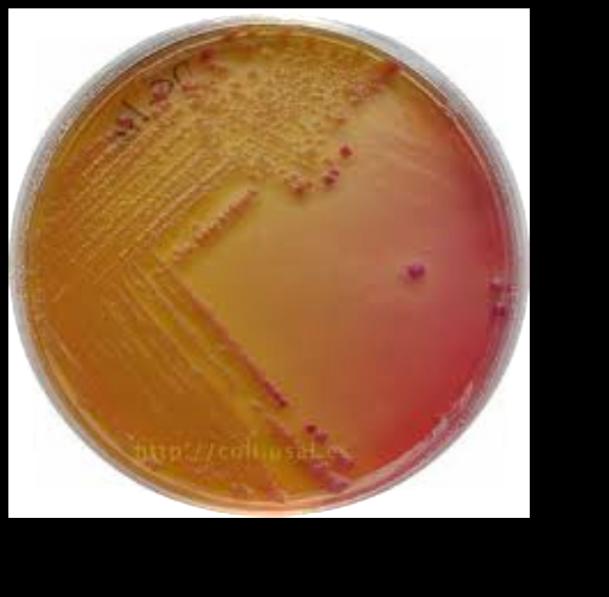 Gram negativi Proteus su Agar sangue e mac conkey