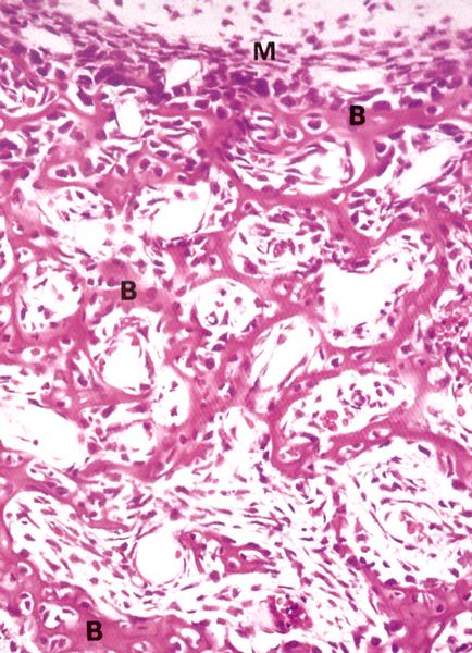 Ossificazione Intramembranosa Da cellule indifferenziate del tessuto connettivo Cellule