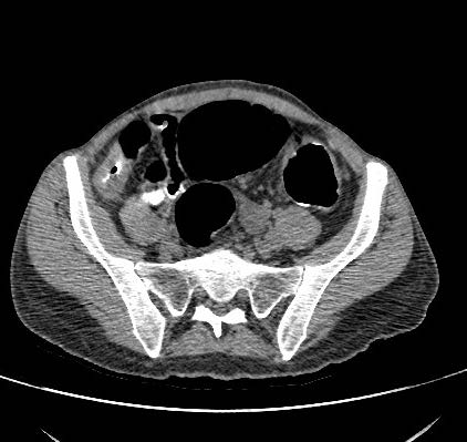 Nuove tecnologie e dosi: Ottimizzazione della dose in Radiodiagnostica tradizionale, in TC ed in