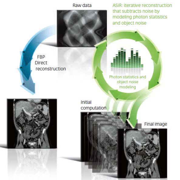 General Electric: Adaptive Statistical Iterative Reconstruction Riduce le cause originarie del