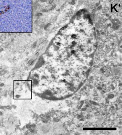 Genesi di interneuroni nel cervelletto del coniglio giovane e adulto