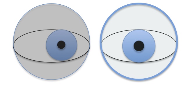 Spostamento dell occhio parzialmente occluso verso l interno quando deve mettere a fuoco in modo più o meno ampio a seconda della richiesta (come evidenziato nei disegni sottostanti) Disegno 1: